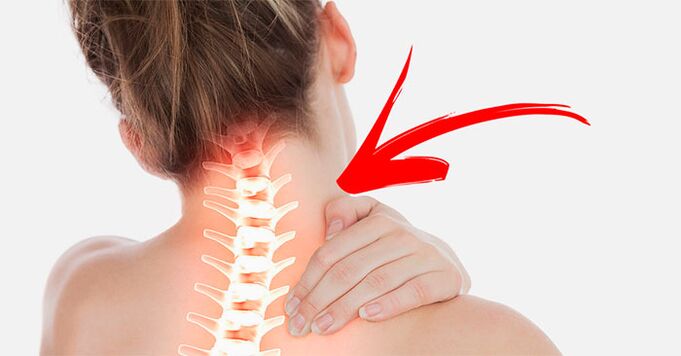 nyaki fájdalom Miért és mit kell tenni